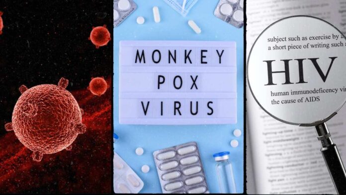 Covid-19, monkeypox and HIV